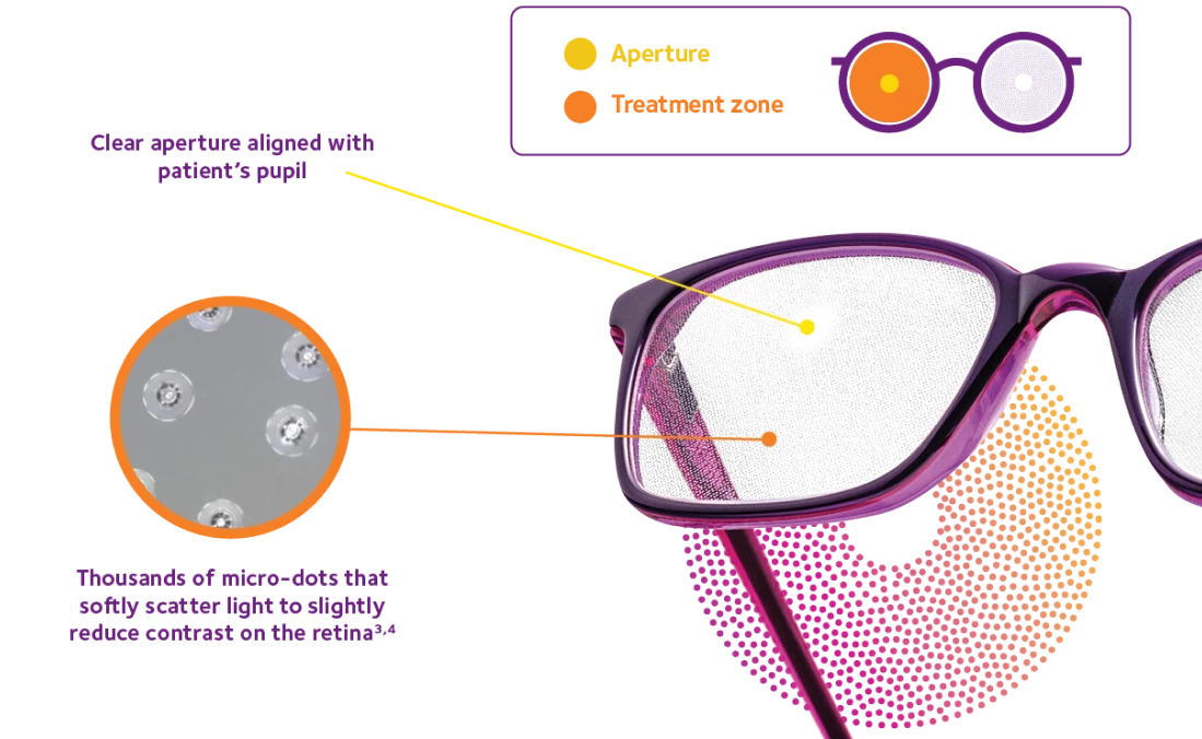Official CooperVision MiSight Spectacle Lenses diagram showing the pupil aperture, treatment zone and micro-dot structure