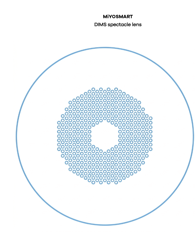 MiYOSMART D.I.M.S. lens structure with a clear central zone and surrounding defocus segments
